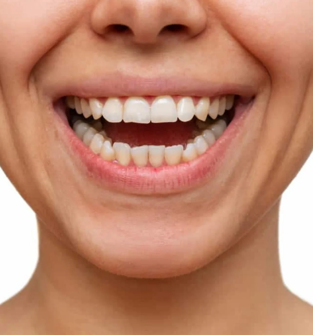 Dull, stained teeth